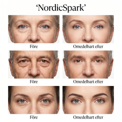 NordicSpark - Bli Av Med Rynkor & Påsar Under Ögonen